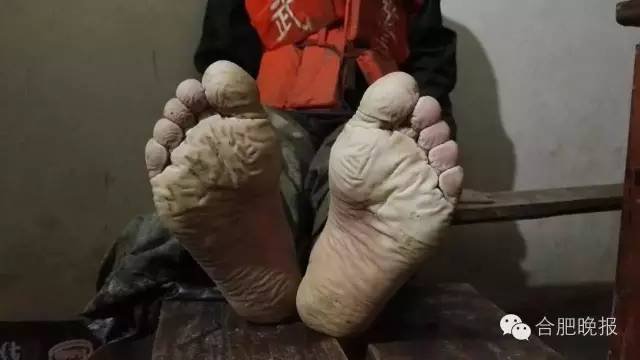 14117138831417809168