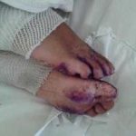 2岁女童遭持续虐待死亡 外婆: 没打过一次孩子