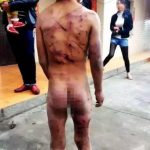 云南9岁男孩被父亲用皮线打成这样