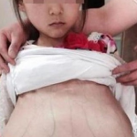 江苏12岁女孩医院做产检 女孩被证实为外籍